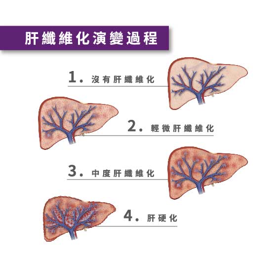 肝纖維化指數評估 Elf Precision Health Care Services Ltd